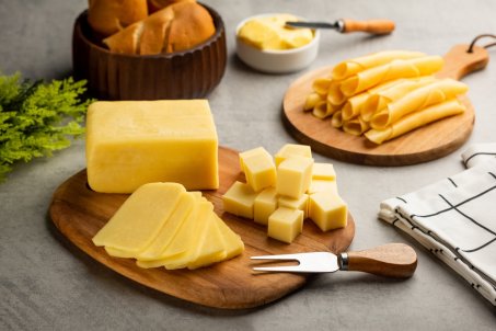 Peut-on manger du fromage quand on a du cholestérol ?