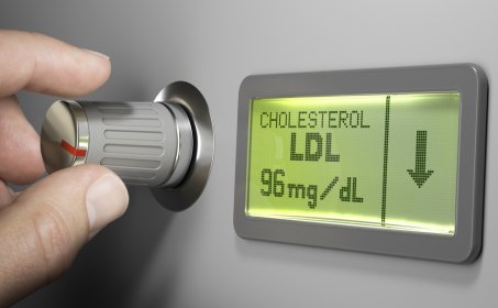 Quelles les causes d’un cholestérol trop élevé ?