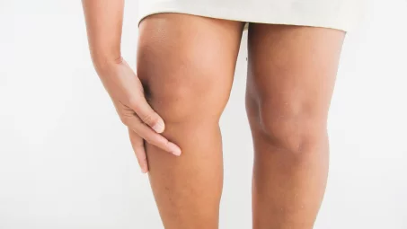 Comment combattre le syndrome des jambes lourdes ?