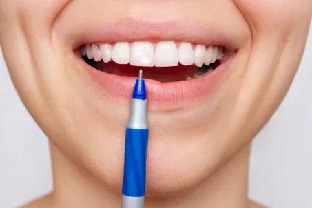 Quelle est la meilleure méthode pour blanchir les dents ?