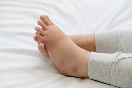 Comment soulager des pieds gonflés ?