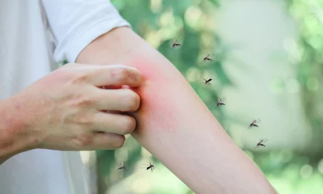 Comment savoir si je fais une allergie aux piqûres de moustiques ?