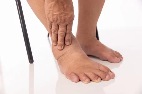 5 bonnes raisons de s’inquiéter d’un gonflement des jambes